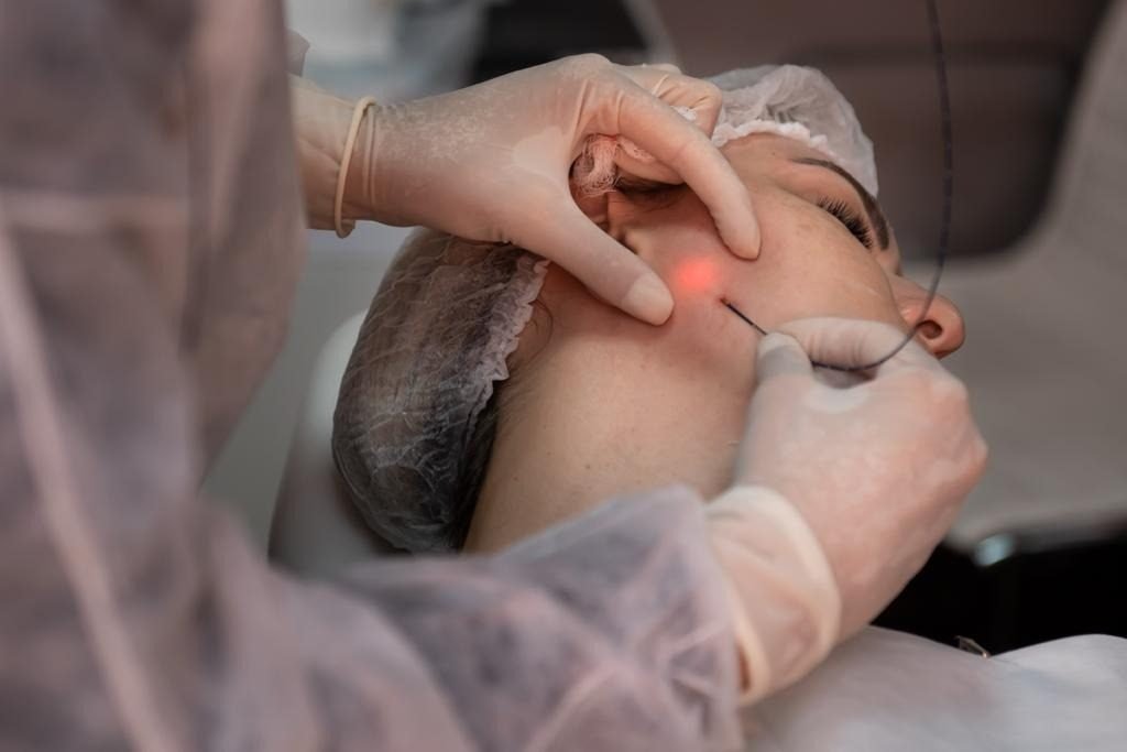 Endolaser Five Techniques — controle térmico para prevenir complicações