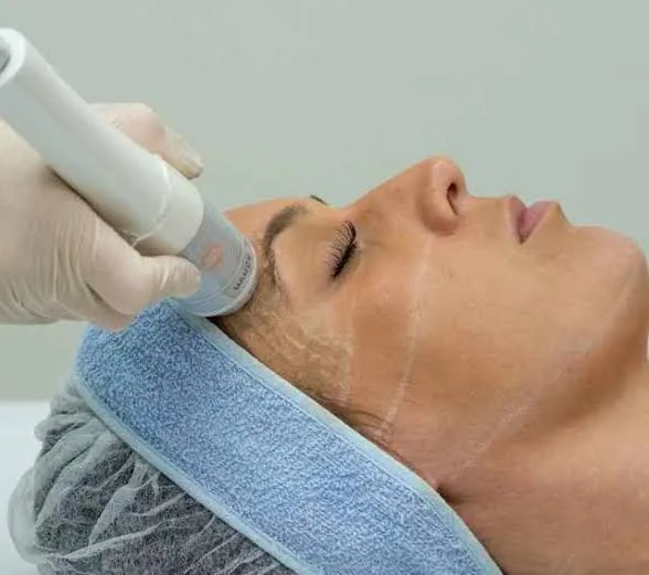 Cursos Just Laser Academy — profundidades de cartucho no HIFU