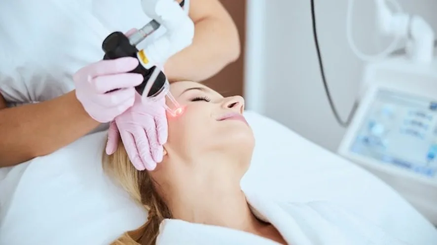 O Melhor Curso de CO₂ do Mundo — laser CO₂ fracionado na cicatriz de acne