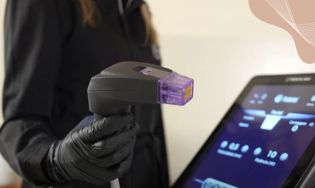 Secret DUO — RF microagulhada poupando a epiderme em fototipo alto