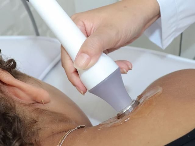 Curso Volnewmer — redefinição do contorno mandibular com RF monopolar